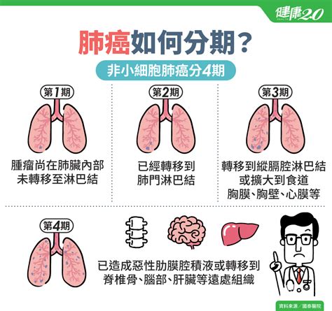 肺腺癌早期治愈率：关键信息把握