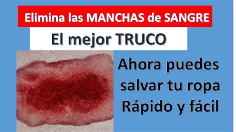 MANCHAS de SANGRE de tu ropa Cómo quitar MANCHAS difíciles rápido