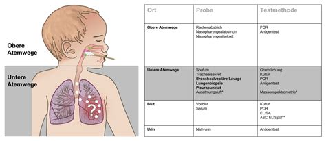 Diagnose Und Therapie Der Pneumonie Bei Kindern Und Jugendlichen