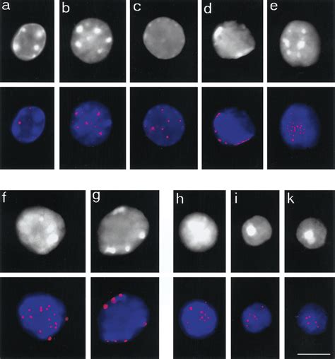 Telomere Redistribution During Mouse Spermatogenesis As Displayed By