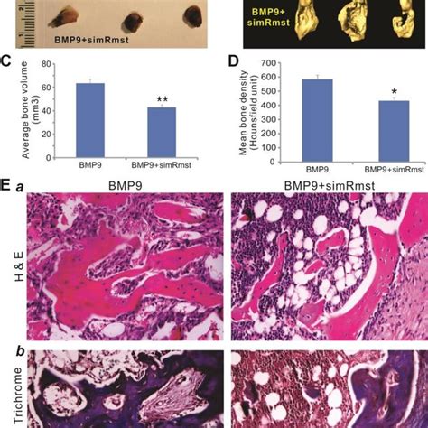 Silencing Rmst Expression Attenuates Bmp9 Induced Ectopic Bone