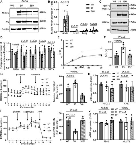 SIRT6 Protects Smooth Muscle Cells From Senescence And Reduces