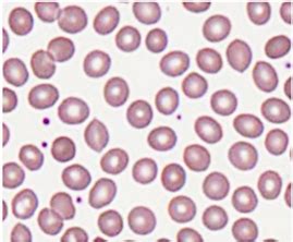 Normal Cells Under Microscope