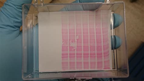 Can You Show The Picture Of Your Worst Western Blot And Explain The