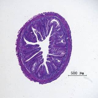 Hindgut morphology of grass carp fed semipurified diets. (a) the ...