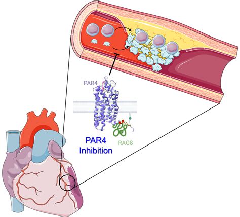 PAR4 Inhibition Reduces Coronary Artery Atherosclerosis And Myocardial