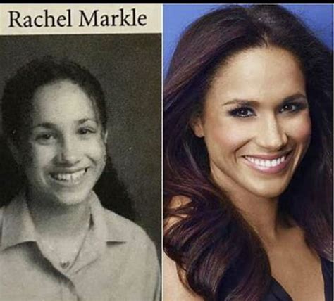 Pin by Ramona Sands on Celebrities: Before/After plastic surgery photos ...