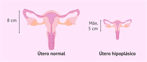 ¿cómo Sabes Si Tienes Un útero De Bebé Mibbmemima ️