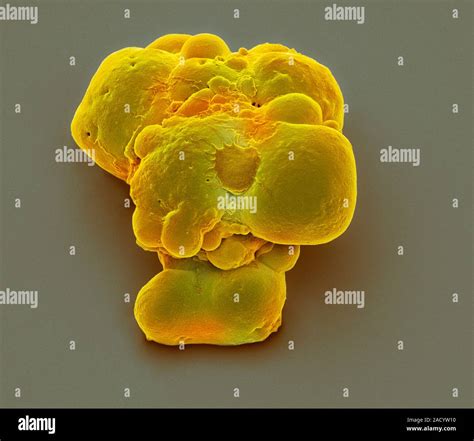 Pluripotent Stem Cells Coloured Scanning Electron Micrograph Sem Of