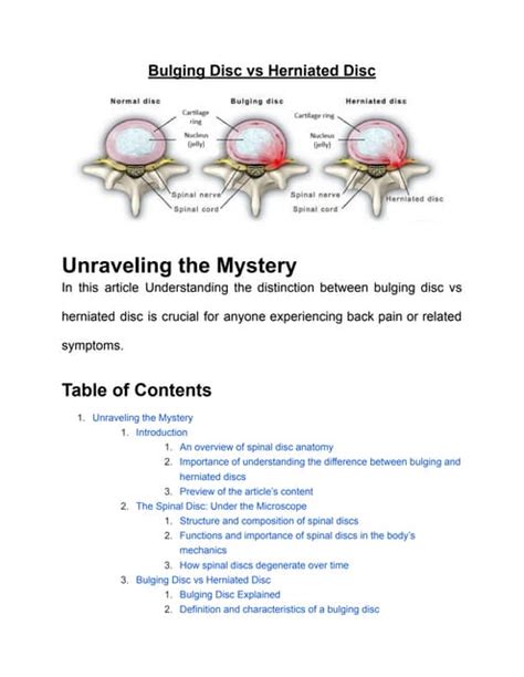 Bulging Disc Vs Herniated Discpdf