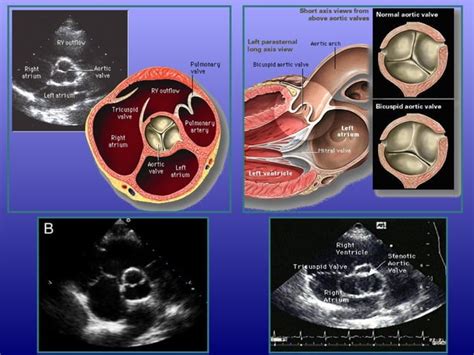 Echo.basics | PPT