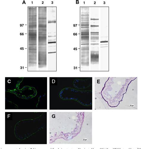 Figure 1 From Echinococcus Multilocularis Phosphoglucose Isomerase Empgi A Glycolytic Enzyme