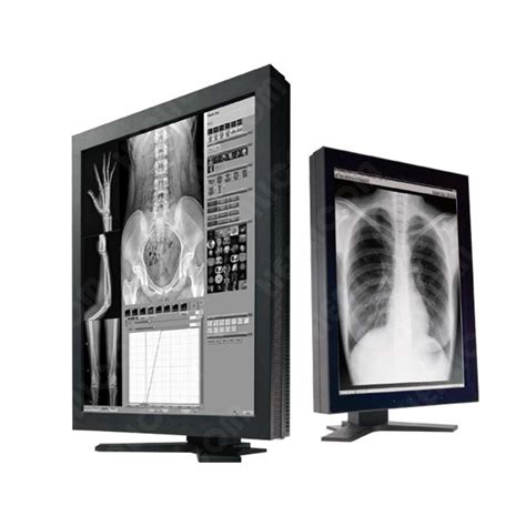 Hdr Kw High Frequency Stationary Digital X Ray Machine From China