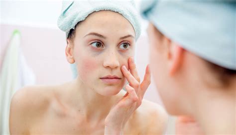 Maneras En Las Que Puedes Eliminar Las Ojeras De Forma Natural Glamour