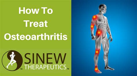 How To Treat Osteoarthritis And Speed Recovery Youtube