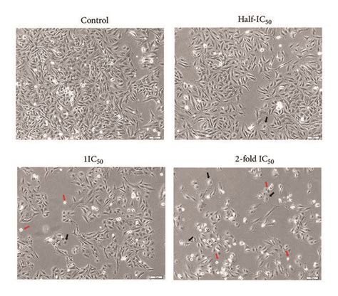 Morphological Changes Of A Hela And B Siha Cells Treated With Ace