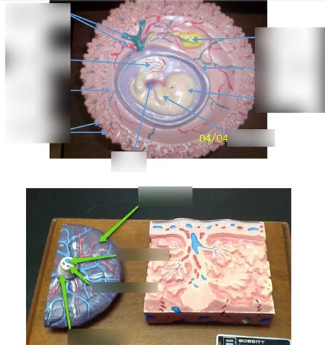 Umbilical Anatomy Diagram | Quizlet