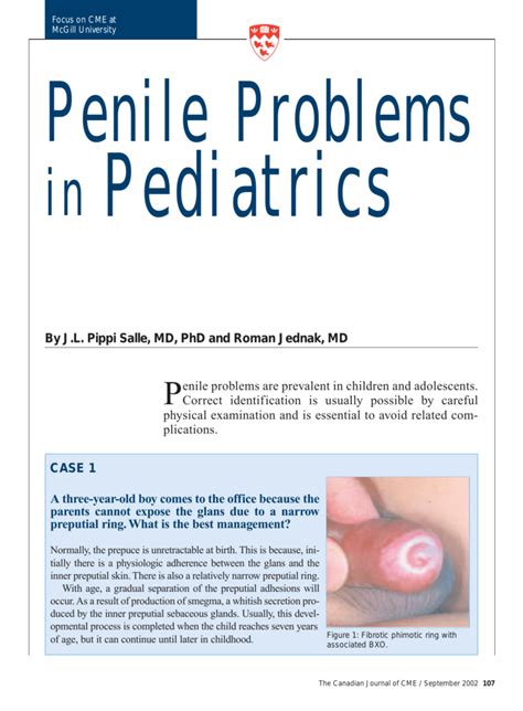 Neonatal Penis Torsion