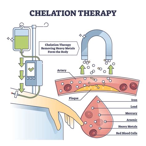 Chelation Therapy Technique To Remove Heavy Metals