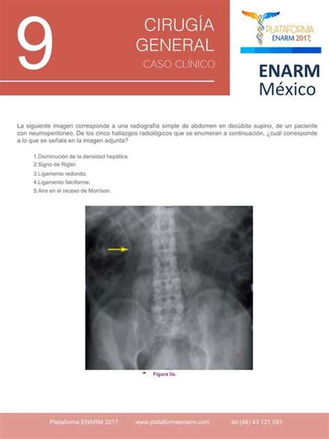 Examen Cirug A Caso Apun Tesmedicina Udocz