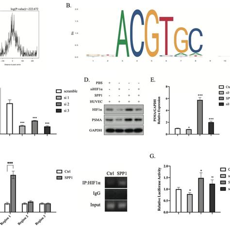 Abbreviations Spp Secreted Phosphoprotein Gbm Glioblastoma