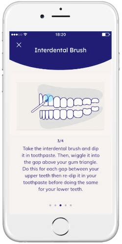 4-Step Interdental Brushing Technique. | by uunn | Medium