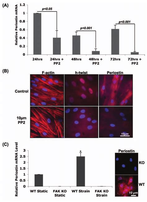 Influence Of M Pp On Periostin Expression In Human Pdl Fibroblasts