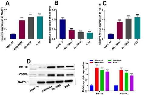 LncRNA NEAT1 Promotes Angiogenesis Of Retinoblastoma Cells Through