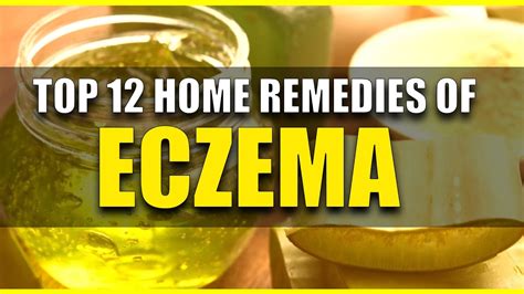 Top 12 home remedies of Eczema ||Remedies for Eczema || Things You Must ...