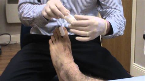 Video 35 Toenail Dressing Youtube