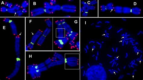 Rad Inactivation Is Synthetically Lethal With Brca Deficiency Pnas