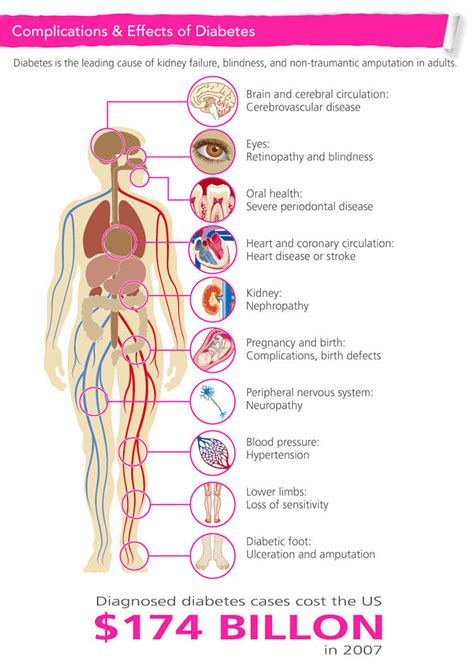 Diabetes Complications Diagram