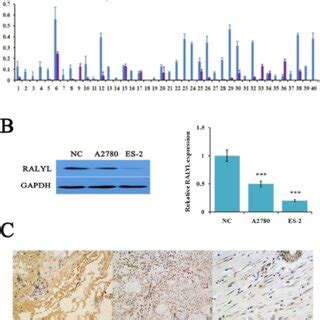 The Expression Of Ralyl In Ovarian Clear Cell Carcinoma Occc A