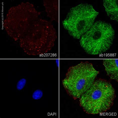 Alexa Fluor Anti Integrin Alpha V Antibody Epr Ab