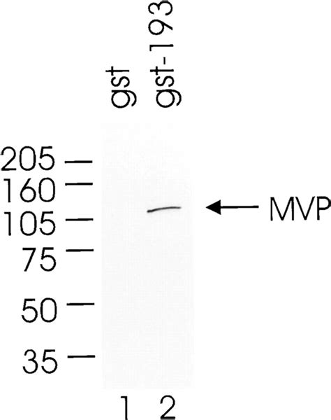 In Vitro Binding Assay Of P193 Mvp Interaction In Vitro Translated Download Scientific Diagram