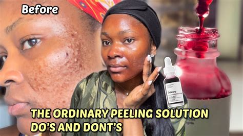 How To Properly Use The Ordinary Peeling Solution For Beginners Step By Step Guide Youtube