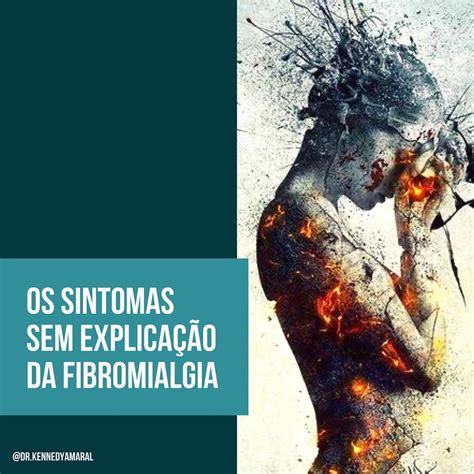 Aprender Sobre Imagem Fibromialgia Sintomas Fotos Br Thptnganamst