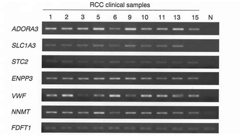 Semi Quantitative Rt Pcr Analysis Of Representative Up Regulated Genes