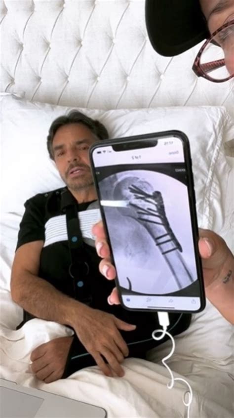 Eugenio Derbez Muestra En Video La Descripción Gráfica De Su Accidente