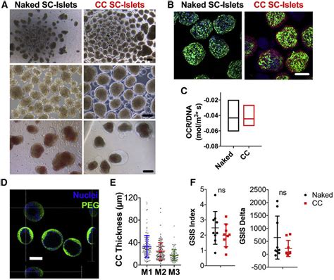 In Vitro Assessment Of Unencapsulated And CC SC Islets A