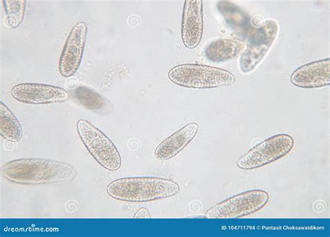 Protozoa Under Microscope, Paramecium Caudatum Is A Genus Of ...