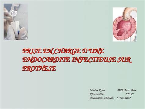 Ppt Prise En Charge D’une Endocardite Infectieuse Sur Prothese Dokumen Tips