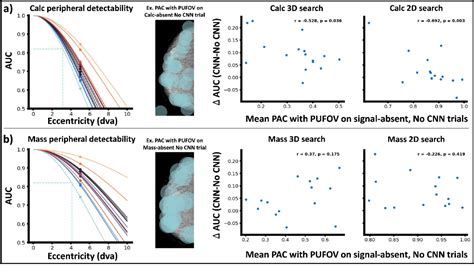 Figure 1 From Greater Benefits Of Deep Learning Based Computer Aided Detection Systems For