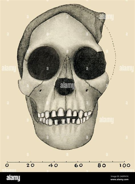 Taung Child skull. Artwork, from 1931, showing the appearance and size ...