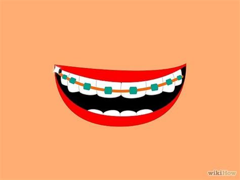 How to Make Fake Braces: 11 Steps (with Pictures) - wikiHow | Fake ...