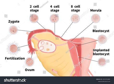 Medical Diagram Human Fertilization Implanted English Stock ...