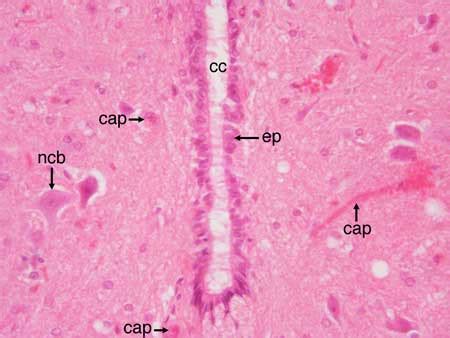 Spinal Nerve Cross Section Slide The Best Porn Website