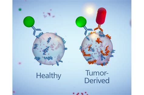 Sentinels In The Blood A New Diagnostic For Pancreatic Cancer