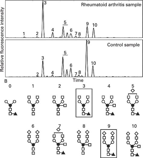 Glycan Profiling Of Protein L Bound Serum Fractions By The Improved