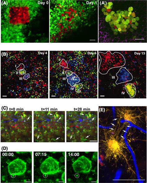 High Resolution Intravital Multiphoton Microscopy Iv Mpm And New Download Scientific Diagram